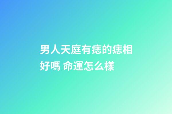 男人天庭有痣的痣相好嗎 命運怎么樣